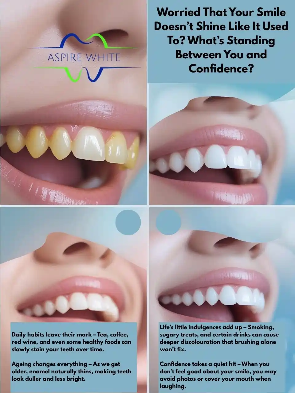 Worried That Your Smile Doesn’t Shine Like It Used To What’s Standing Between You and Confidence Sutton Coldfield